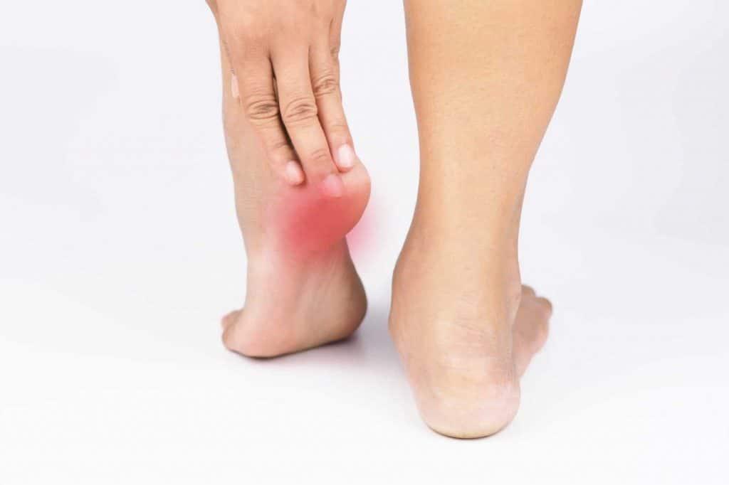 image of PLANTAR FASCIITIS